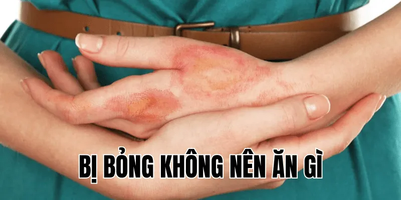 bị bỏng không nên ăn gì