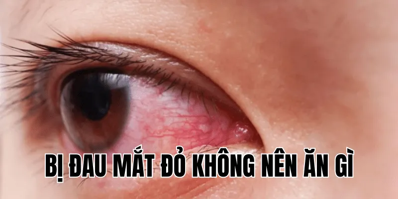 bị đau mắt đỏ không nên ăn gì