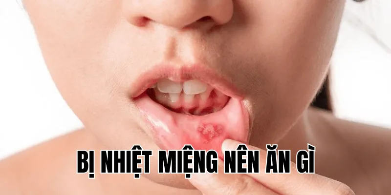 bị nhiệt miệng nên ăn gì