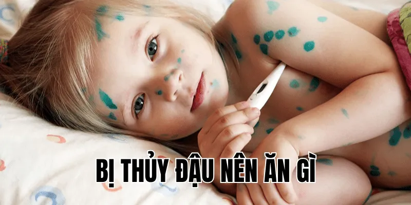 bị thủy đậu nên ăn gì