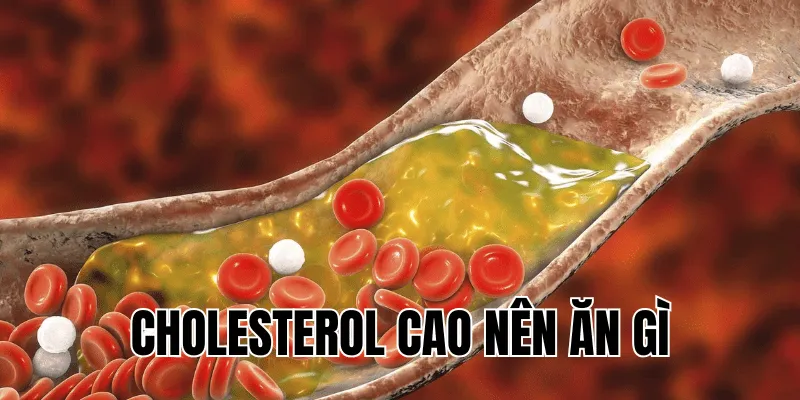 cholesterol cao nên ăn gì