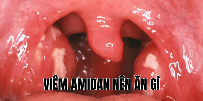 viêm amidan nên ăn gì